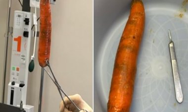 Homem enfia cenoura de 20 cm no ânus e é hospitalizado com urgência; confira