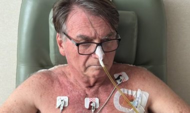Equipe médica retirou os drenos abdominais de Bolsonaro; estado de saúde é revelado